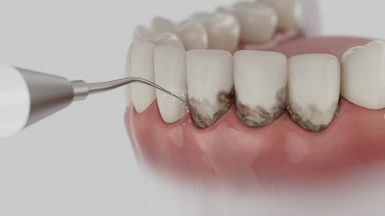 Reliable Dental contractor in Maryville, MO by Dentist Open Now